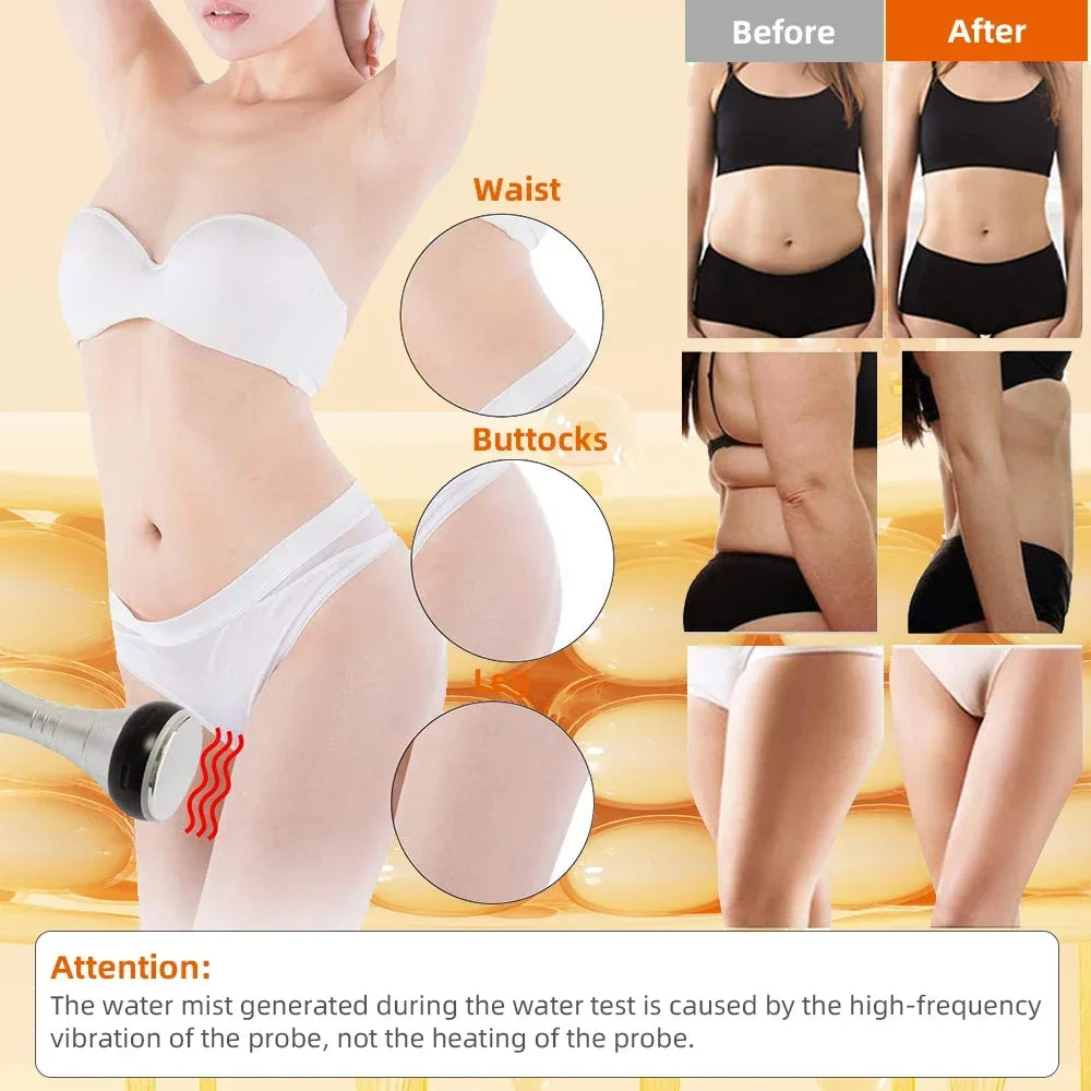 Missheart 4 In 140K Cavitation Ultrasonic Body Slimming Machine