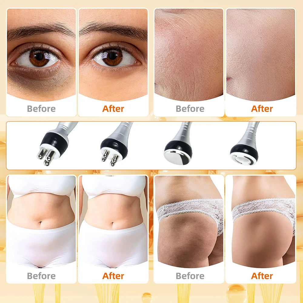 Missheart 4 In 140K Cavitation Ultrasonic Body Slimming Machine